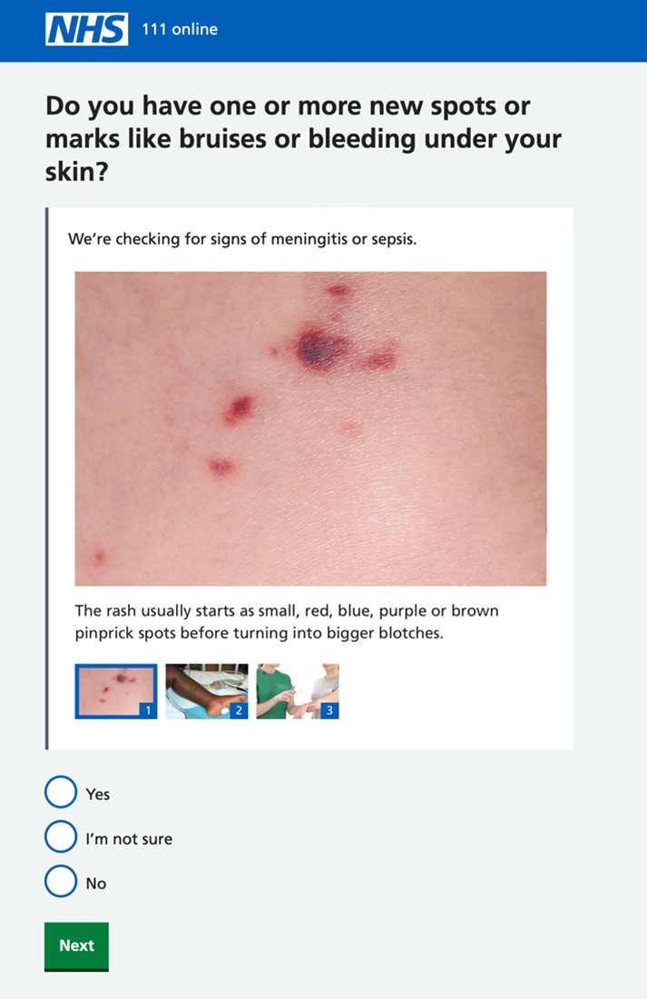 First tab for meningitis rash images on 111 online