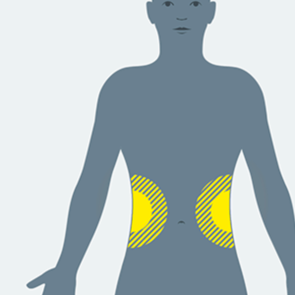 NHS 111 body map illustration