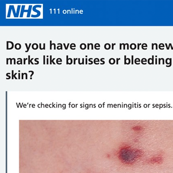 NHS 111 images for sepsis